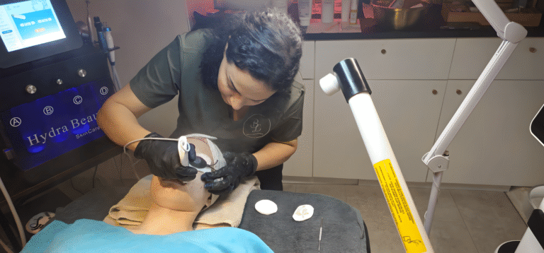 Clients Before and after Beauty Lounge amsterdam